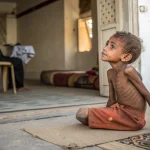 gaza children malnutrition who