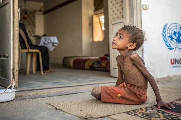 gaza children malnutrition who